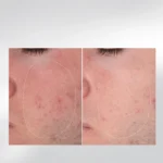 Dermalogica Home for the Holidays — набір "Бестселери у подорож"