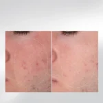 Dermalogica Let It Glow — набір "Зіркове сяяння шкіри"