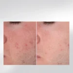 Dermalogica Warmth of the Winter Sun — набір "Відновлення та захист шкіри"