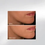 Dermalogica Your Moment of Expertise — набір "Догляд для експертної досконалості"