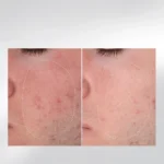 Dermalogica First Snow of the Season — набір "Чиста шкіра як перший сніг"