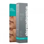 Dermalogica Deep Acne Invisible Liquid Patch — рідкий пластир від акне 15 мл