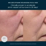 Elemis Kit: Glow Bright Resurfacing Trio — набір тріо для сяйва шкіри