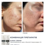 Braderm Kurac Cream — активний протизапальний крем з бензоїл пероксидом 4% 30 мл