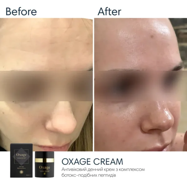 Braderm Oxage Cream SPF 30 — антивіковий крем з ботокс-ефектом 30 мл