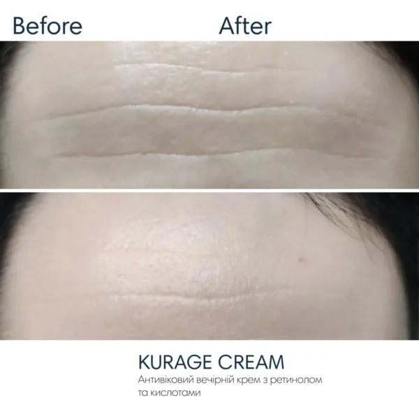Braderm Kurage Cream — крем-пілінг з 1% ретинолу та кислотами 30 мл