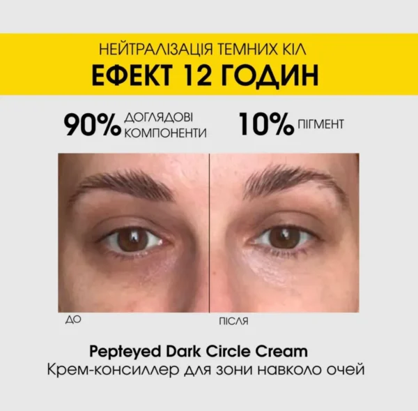 Dermafirm Pepteyed Dark Circle Cream — крем-консилер від темних кіл 15 мл