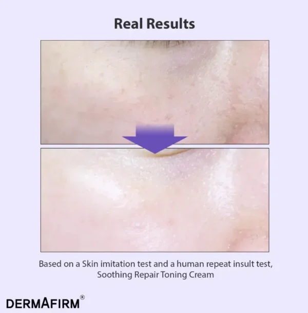 Dermafirm Soothing Repair Toning Cream — тонізуючий крем з глутатіоном та бакучіолом 50 мл