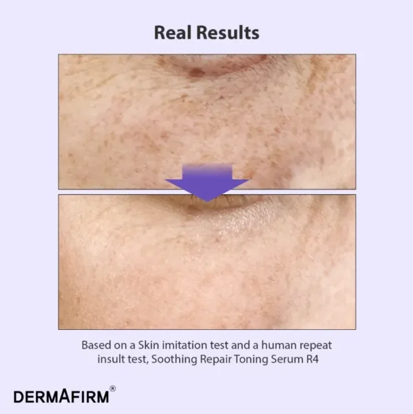 Dermafirm Soothing Repair Toning Serum R4 — мультифункціональна сироватка з бакучіолом 30 мл