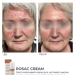 Braderm Rosac Cream — заспокійливий крем для чутливої шкіри 30 мл