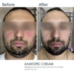 Braderm Axatopic Cream — зволожуюча емульсія з керамідами 250 мл